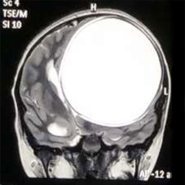 kinh hoang nang san day chiem nua nao co be an do hinh anh 2