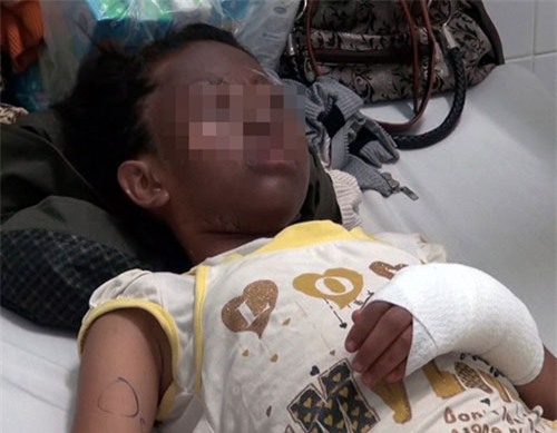 Những “quả bom di dộng” mang tên bóng bay hydro - 4