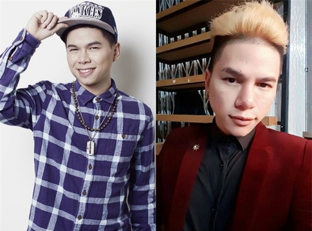 Hoang Ton thua nhan phau thuat tham my hinh anh 2