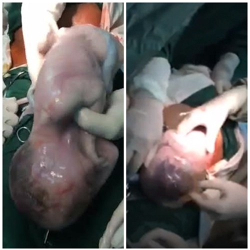 ba me 19 tuoi ke ve ca sinh 3 con nguyen trong boc oi hy huu nhat viet nam - 2