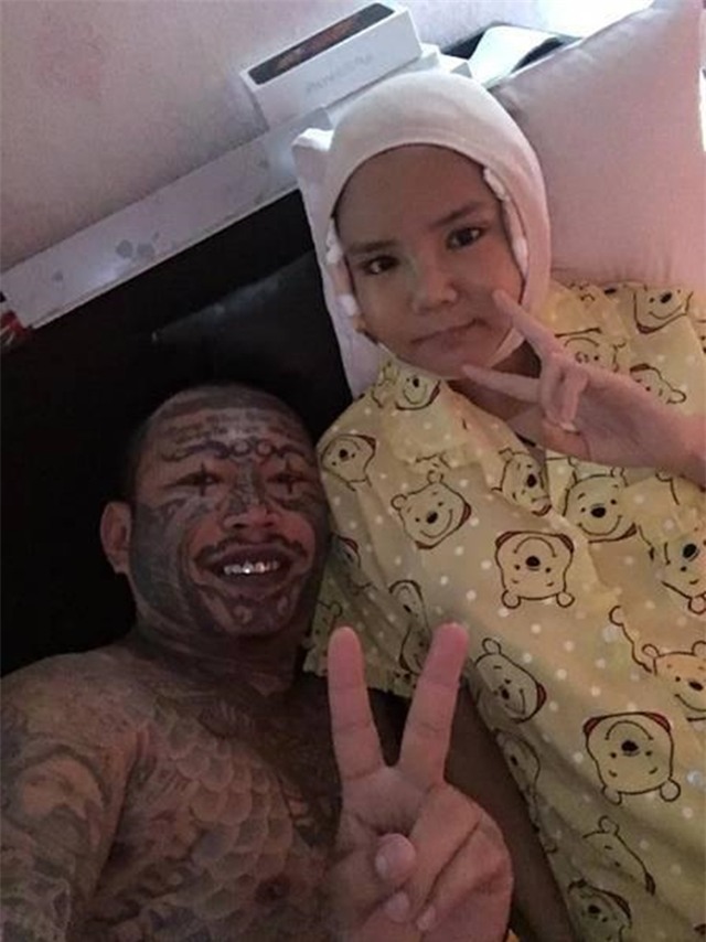 Sang Hàn phẫu thuật thẩm mỹ làm hot girl, 4 cô gái Thái tự tin khoe ảnh băng bó đầy đầu - Ảnh 11.