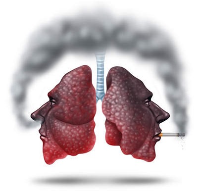 Nếu không muốn bị ung thư phổi, hãy làm những việc này để bảo vệ phổi ngay từ bây giờ - Ảnh 3.