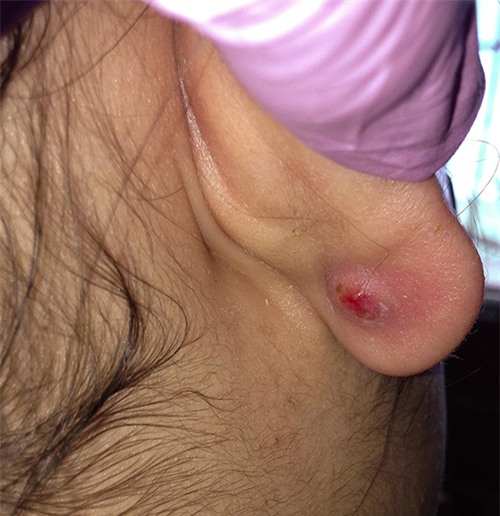 ham bam lo tai cho be so sinh, me nhan hau qua kho luong - 2