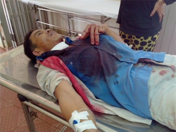 nhung cai chet oan uong vi chuong ngai vat tren duong hinh anh 5