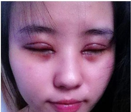 rui ro khong ngo toi tu 3 kieu tham my hot nhat hien nay - 1