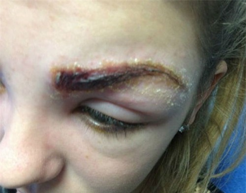 rui ro khong ngo toi tu 3 kieu tham my hot nhat hien nay - 7