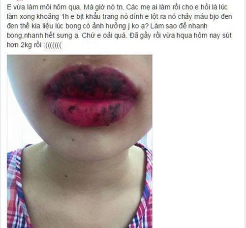 rui ro khong ngo toi tu 3 kieu tham my hot nhat hien nay - 8