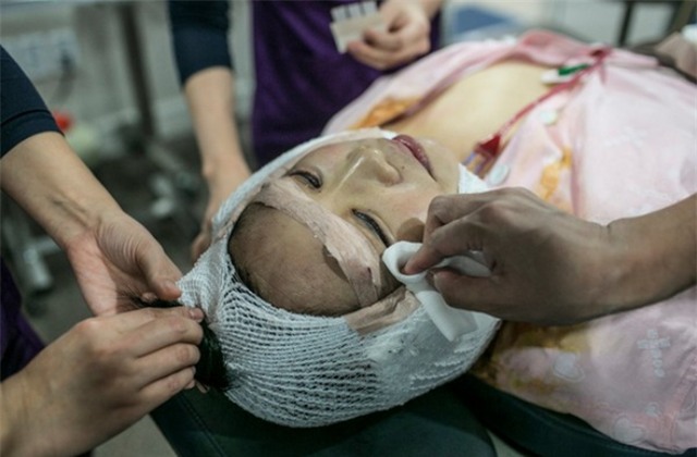 Ham đẹp như gái Hàn, nhiều phụ nữ Trung Quốc ôm hận thiên thu vì phẫu thuật thẩm mỹ hỏng - Ảnh 1.