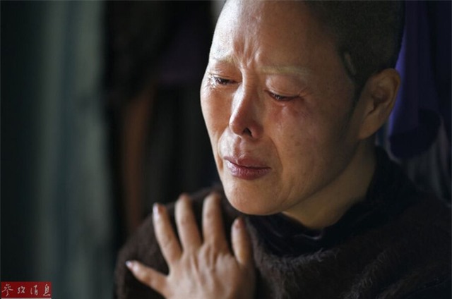 Ham đẹp như gái Hàn, nhiều phụ nữ Trung Quốc ôm hận thiên thu vì phẫu thuật thẩm mỹ hỏng - Ảnh 14.