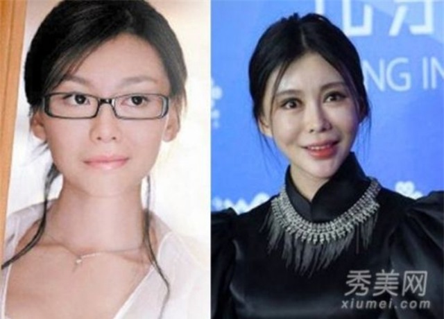 Ham đẹp như gái Hàn, nhiều phụ nữ Trung Quốc ôm hận thiên thu vì phẫu thuật thẩm mỹ hỏng - Ảnh 17.