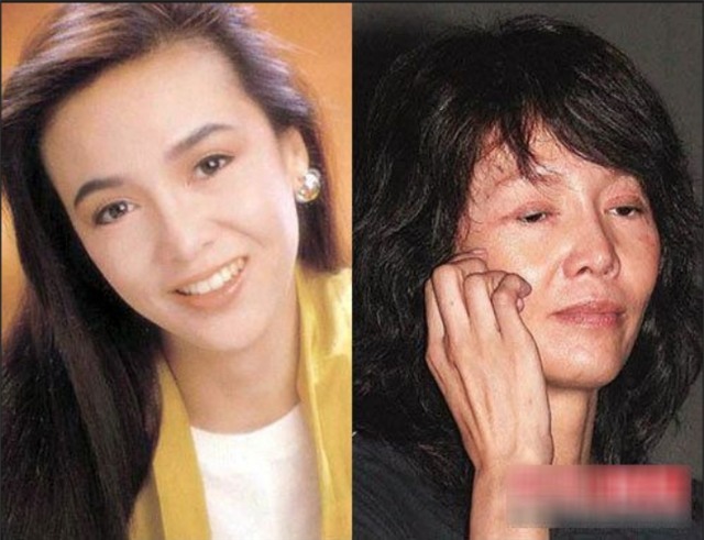 Ham đẹp như gái Hàn, nhiều phụ nữ Trung Quốc ôm hận thiên thu vì phẫu thuật thẩm mỹ hỏng - Ảnh 19.
