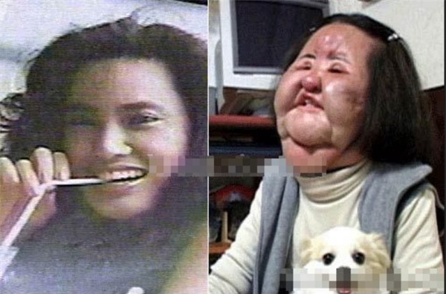 Ham đẹp như gái Hàn, nhiều phụ nữ Trung Quốc ôm hận thiên thu vì phẫu thuật thẩm mỹ hỏng - Ảnh 23.
