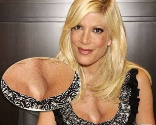 Ham đẹp như gái Hàn, nhiều phụ nữ Trung Quốc ôm hận thiên thu vì phẫu thuật thẩm mỹ hỏng - Ảnh 27.