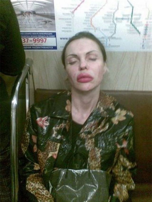 Ham đẹp như gái Hàn, nhiều phụ nữ Trung Quốc ôm hận thiên thu vì phẫu thuật thẩm mỹ hỏng - Ảnh 36.