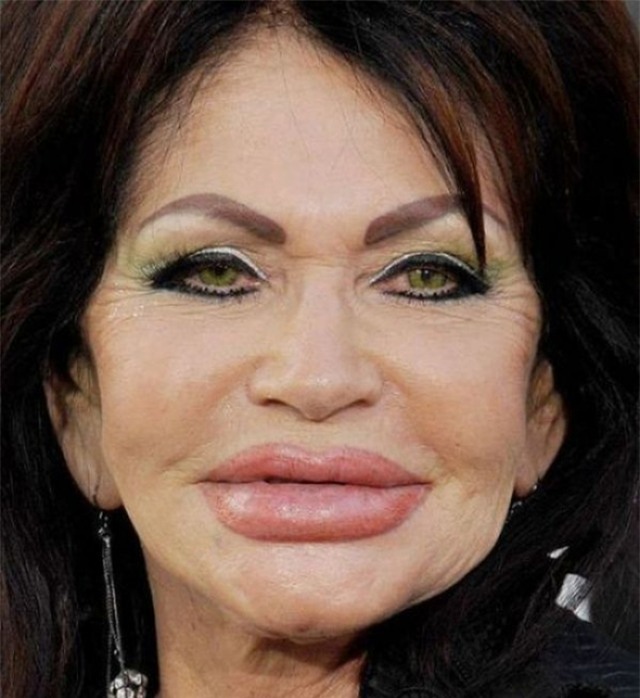 Ham đẹp như gái Hàn, nhiều phụ nữ Trung Quốc ôm hận thiên thu vì phẫu thuật thẩm mỹ hỏng - Ảnh 37.