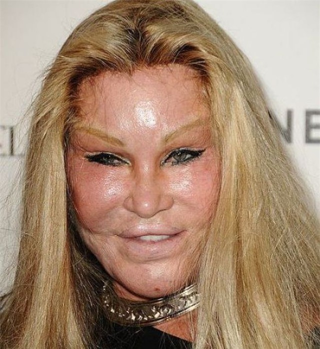 Ham đẹp như gái Hàn, nhiều phụ nữ Trung Quốc ôm hận thiên thu vì phẫu thuật thẩm mỹ hỏng - Ảnh 39.