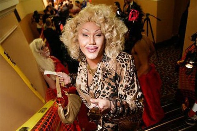 Ham đẹp như gái Hàn, nhiều phụ nữ Trung Quốc ôm hận thiên thu vì phẫu thuật thẩm mỹ hỏng - Ảnh 40.