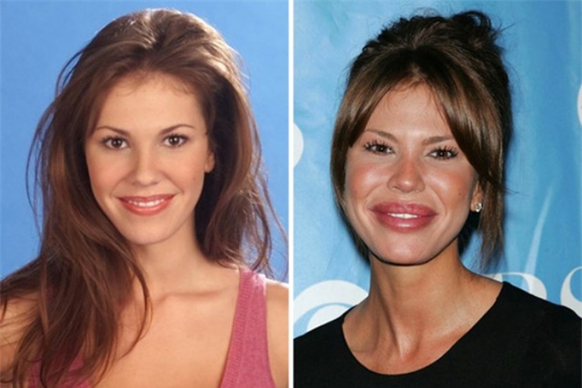 Ham đẹp như gái Hàn, nhiều phụ nữ Trung Quốc ôm hận thiên thu vì phẫu thuật thẩm mỹ hỏng - Ảnh 42.