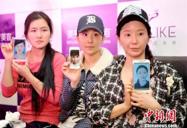 Ham đẹp như gái Hàn, nhiều phụ nữ Trung Quốc ôm hận thiên thu vì phẫu thuật thẩm mỹ hỏng - Ảnh 9.