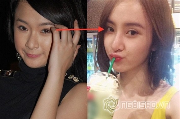 angela-phuong-trinh-phau-thuat-tham-my-mat-2-ngoisao 0