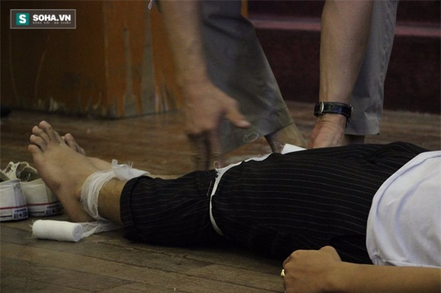 Hướng dẫn chính xác các bước sơ cứu khi bị cắt đứt mạch máu - Ảnh 8.