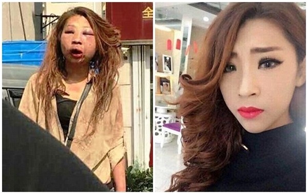 Sau khi bị đánh ghen, đến bố mẹ cũng chẳng nhận ra đây là con gái mình - Ảnh 2.