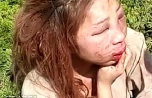 Sau khi bị đánh ghen, đến bố mẹ cũng chẳng nhận ra đây là con gái mình - Ảnh 3.