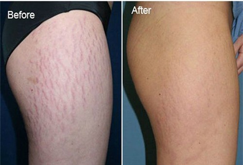 Ran da den dau cung se mo dan roi mat han voi 7 cach nay