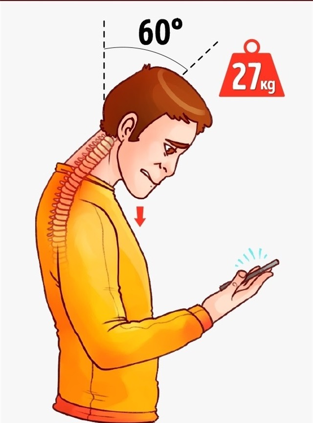 Cúi đầu xem điện thoại là bắt cổ và xương phải nâng tạ tới 27kg - Ảnh 3.
