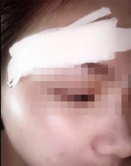 Chàng trai đối xử tàn tệ, đá rách mặt bạn gái cũ - Ảnh 1.