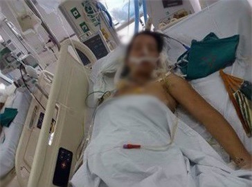 Cô giáo trẻ bị chèn ngang người quyết cứu con trong bụng