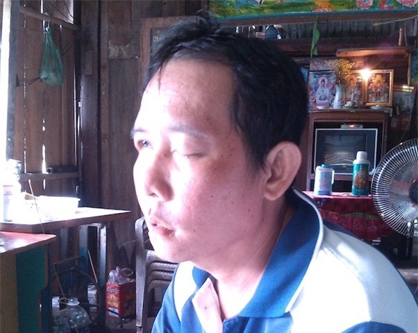 Tai xe xe tai khon kho vi nho rang bi mu mat hinh anh 2