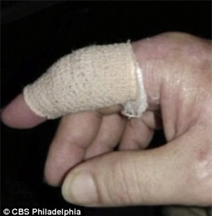 Hôn mê 3 tuần, suýt tử vong vì... giấy cứa tay - Ảnh 2.