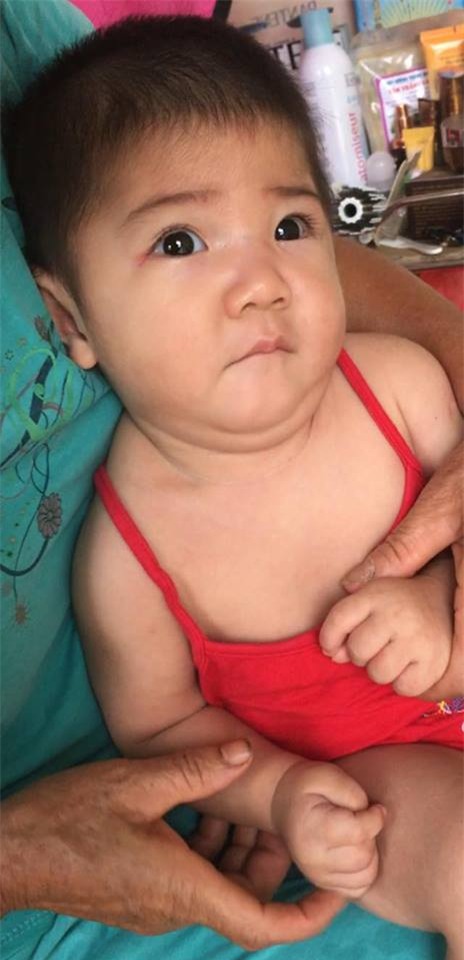 Sau hơn 3 tháng được mẹ nuôi chăm sóc, bé gái 14 tháng tuổi nặng 3,5kg giờ ra sao?