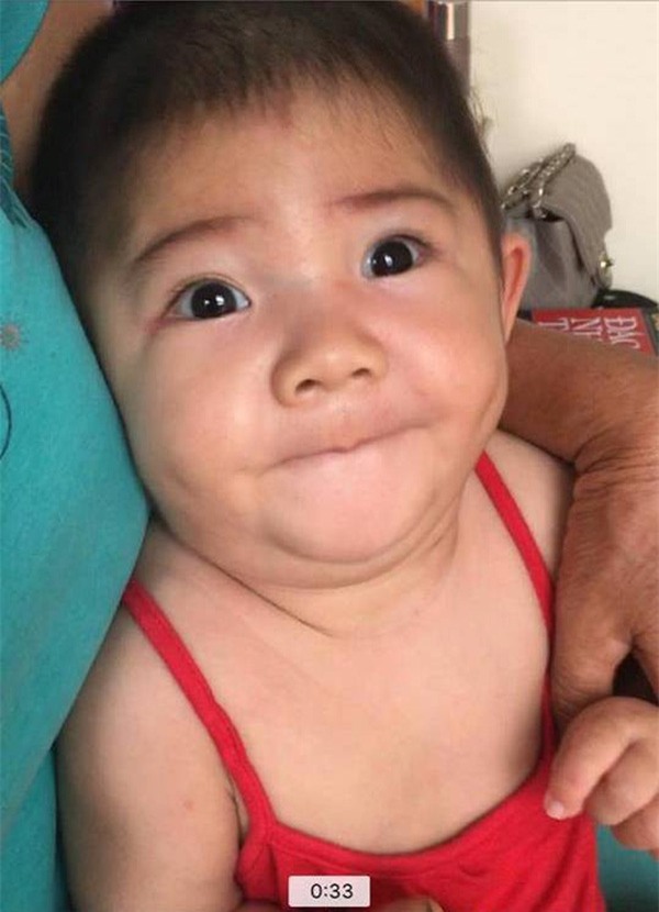 Sau hơn 3 tháng được mẹ nuôi chăm sóc, bé gái 14 tháng tuổi nặng 3,5kg giờ ra sao?