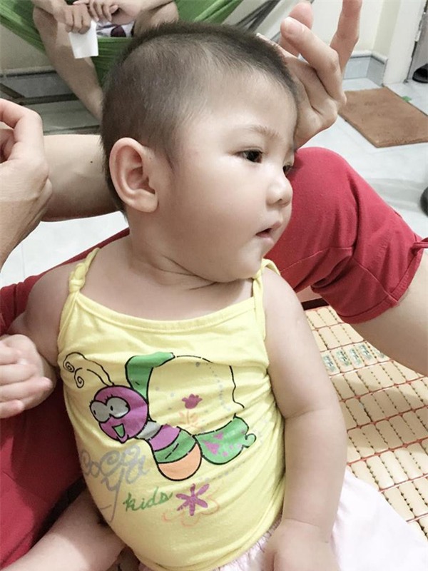 Sau hơn 3 tháng được mẹ nuôi chăm sóc, bé gái 14 tháng tuổi nặng 3,5kg giờ ra sao?