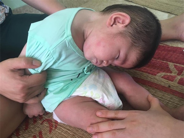 Sau hơn 3 tháng được mẹ nuôi chăm sóc, bé gái 14 tháng tuổi nặng 3,5kg giờ ra sao?