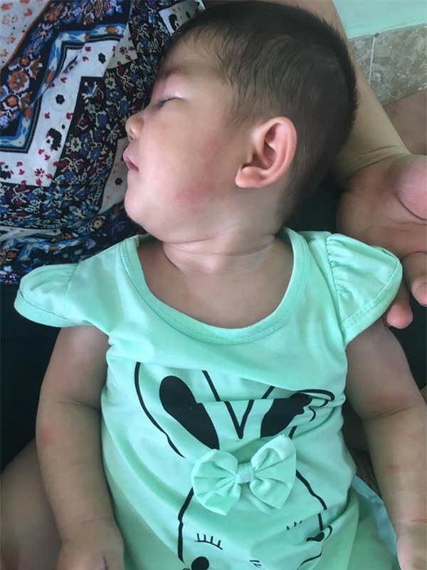 Sau hơn 3 tháng được mẹ nuôi chăm sóc, bé gái 14 tháng tuổi nặng 3,5kg giờ ra sao?