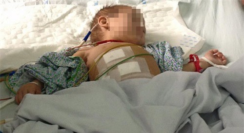 di chua dau mat, chau be 2 tuoi phai mo cap cuu vi giun duc thung ruot thua - 1