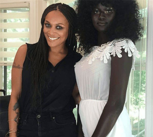 Người mẫu, da đen, tẩy trắng da, kem trắng da