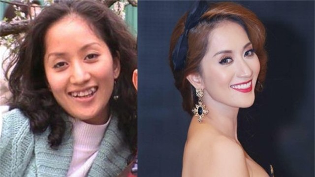 Ngày xưa ông cha ta vẫn thường nói “cái răng cái tóc răng, mái tóc là góc con người” quả thực không sai. Chỉ cần “trùng tu” hàm răng khấp khểnh ngày xưa đi là kiện tướng dancesport Khánh Thi đã trở nên khác rất nhiều.