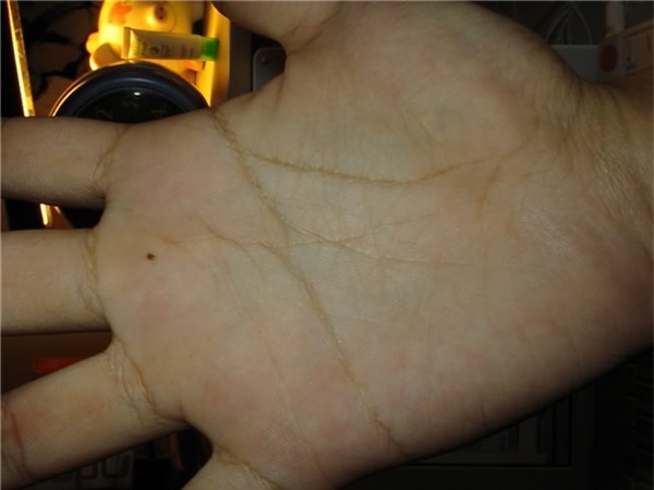 not-ruoi-moc-giua-ban-tay-phu-qui-ca-doi-ma-khong-hay3