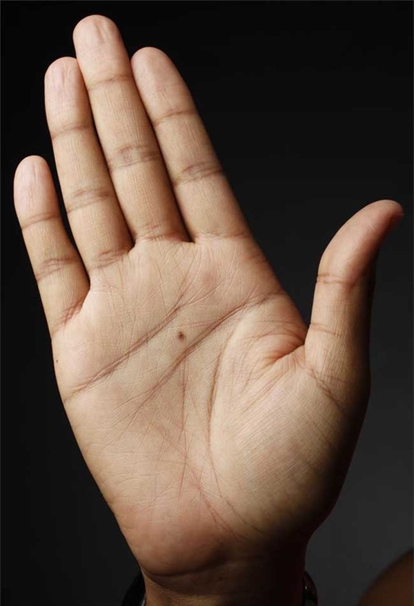 not-ruoi-moc-giua-ban-tay-phu-qui-ca-doi-ma-khong-hay5