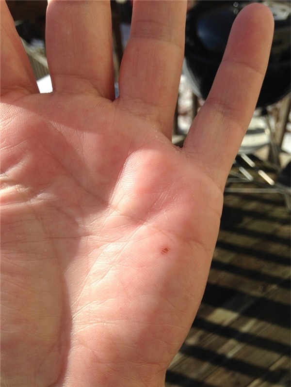 not-ruoi-moc-giua-ban-tay-phu-qui-ca-doi-ma-khong-hay6