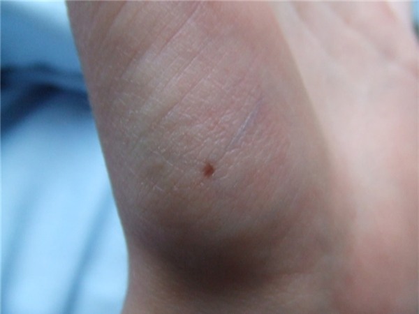 not-ruoi-moc-giua-ban-tay-phu-qui-ca-doi-ma-khong-hay7