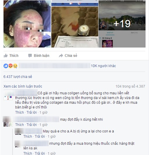 cô gái biến dạng mặt vì kem giả