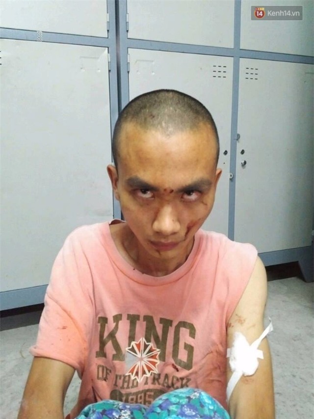 Nghi vấn nhà sư truy sát nhiều người trong chùa Bửu Quang có sử dụng chất kích thích - Ảnh 1.