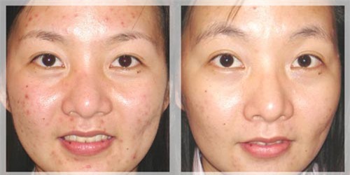 bat mi 3 cong thuc lam dep sieu re tu 1 nam rau ma - 5