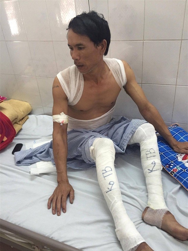Chồng chị là anh Đỗ Văn Tình bị bỏng hiện đang điều trị tại tầng 6.