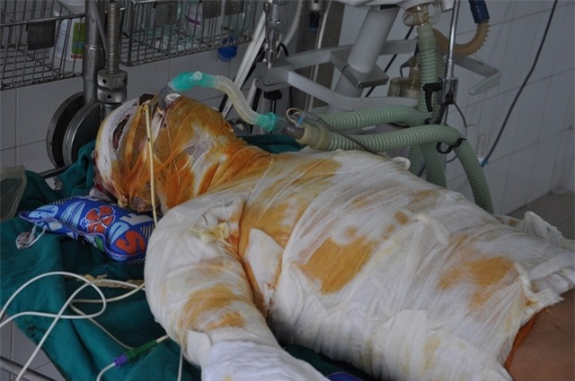 Tính mạng của Nghĩa hiện giờ rất nguy kịch, cần tiếp tục điều trị tích cực nhưng gia đình không có tiền.